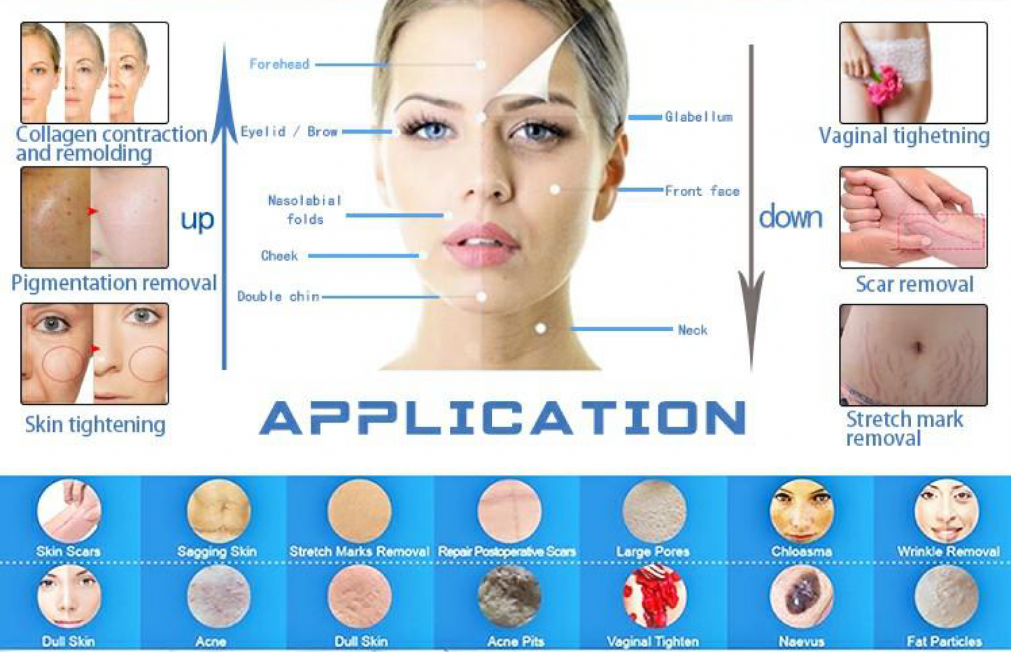 CO2 Fractioned Laser Machine (Portable)